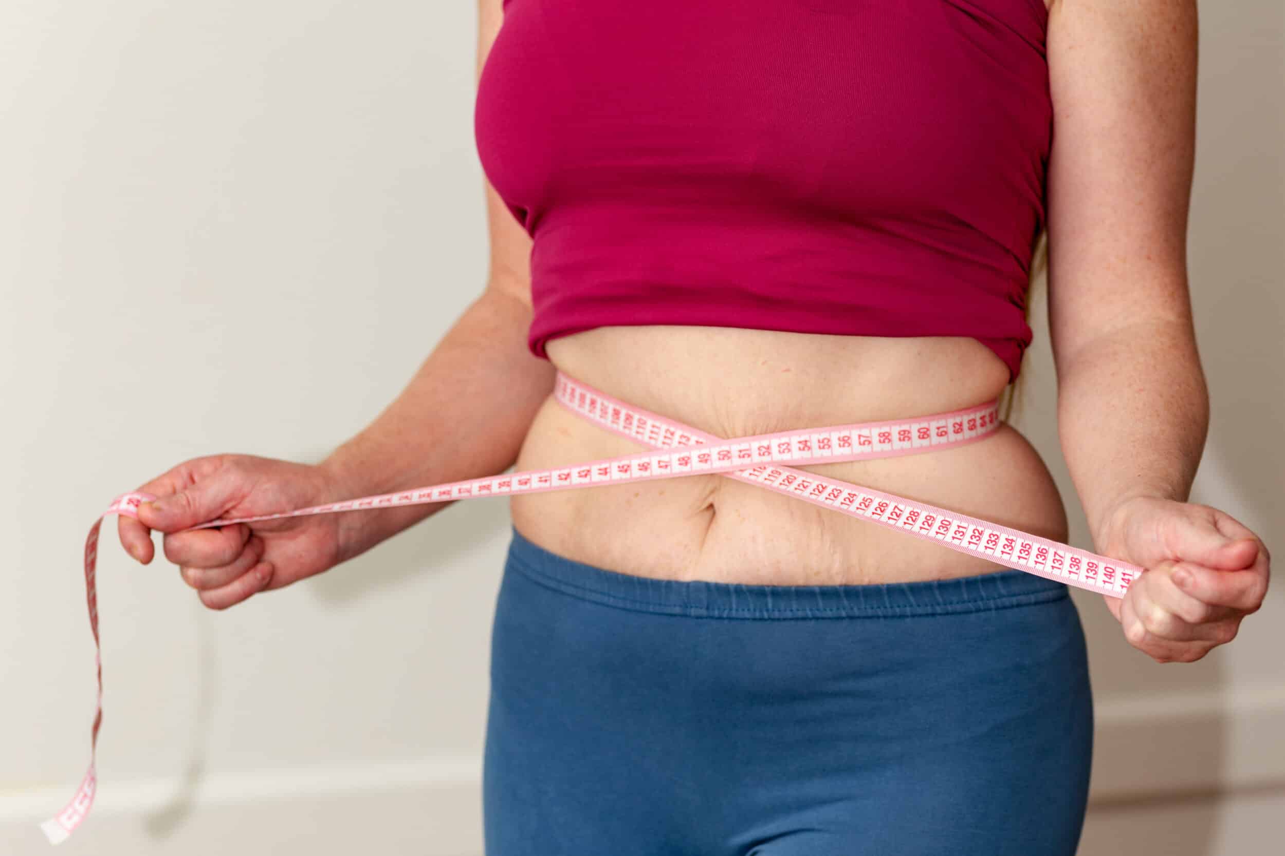 Woman with measuring tape around her stomach after pregnancy and in need of a mommy makeover