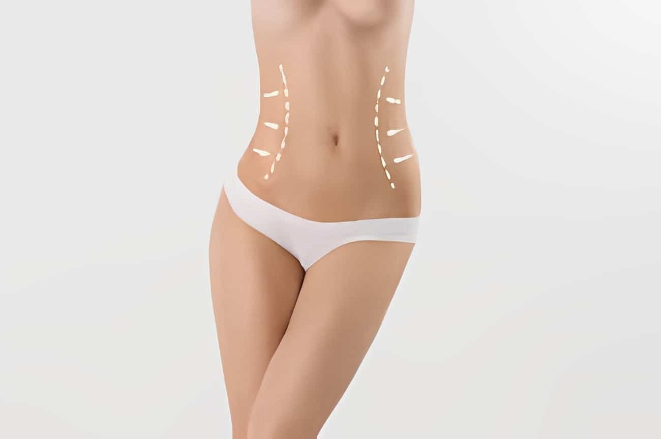 Liposuction Andover